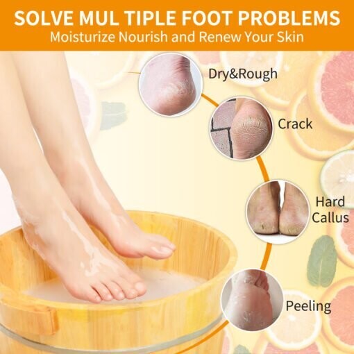 NBC Orange - Case of 50 (Pedi in a Box)