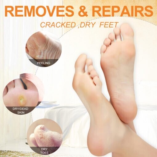 NBC Honey Flower - Case of 50 (Pedi in a Box)